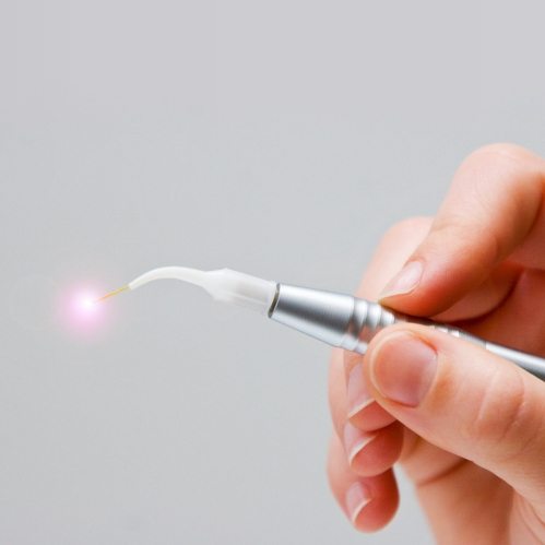 Hand holding a thin dental laser pen