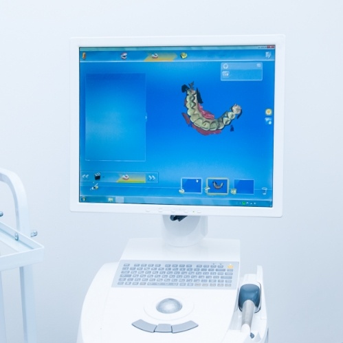 Computer monitor showing digital model of a row of teeth