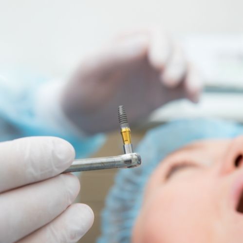 Dentist holding a dental implant with surgical instruments