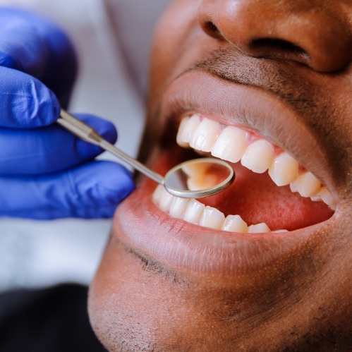 Man having his mouth examined by dentist